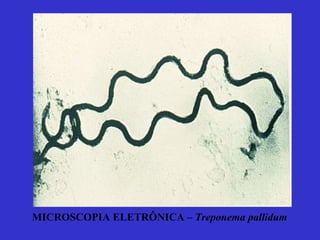 MICROSCOPIA ELETRÔNICA –  Treponema pallidum 