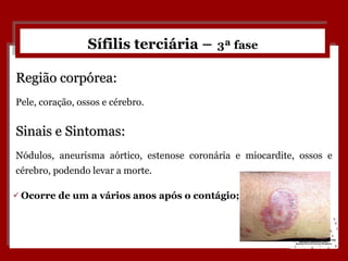 Sífilis terciária –   3ª fase Ocorre de um a vários anos após o contágio; Região corpórea: Pele, coração, ossos e cérebro. Sinais e Sintomas: Nódulos, aneurisma aórtico, estenose coronária e miocardite, ossos e cérebro, podendo levar a morte. 