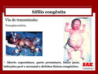 Sífilis congênita Aborto espontâneo, parto prematuro, baixo peso, infecções peri e neonatal e defeitos físicos congênitos. Via de transmissão: Transplacentária. 