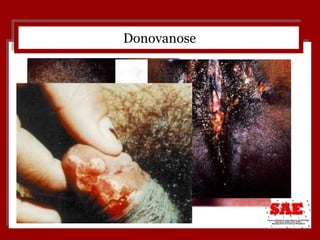 Donovanose 