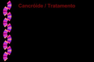 Azitromicina (1g, d.u)
Eritromicina (500mg, 6/6h, 7 dias)
Tianfenicol (500mg, 8/8h, 7 dias)
Ceftriaxone (250mg, IM, d.u)
Ciprofloxacina (500mg, 12/12h, 3 dias)
Cancróide / TratamentoCancróide / Tratamento
 