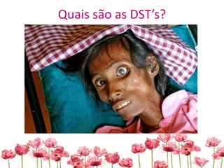 Quais são as DST’s?
 