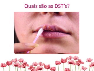 Quais são as DST’s?
 