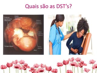 Quais são as DST’s?
 
