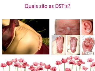 Quais são as DST’s?
 