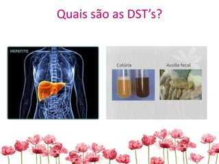 Quais são as DST’s?
 