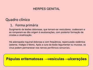 HERPES GENITAL
Quadro clínico
1. Forma primária
Surgimento de lesões dolorosas, que tornam-se vesiculares, coalescem e
ao romperem-se dão origem à exulcerações, com posterior formação de
crostas e cicatrização.
Há adenopatia inguinal dolorosa e com freqüência, repercussão sistêmica
(astenia, mialgia e febre). Após a cura da lesão tegumentar ou mucosa, os
vírus podem permanecer nos nervos periféricos sensoriais.
14
Pápulas eritematosas →vesículas→ulcerações
 