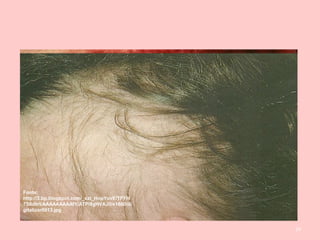 24
Fonte:
http://www.medicinageriatrica.com.br/wp-
content/uploads/2007/12/lues2.JPGFonte: http://4.bp.blogspot.com/-
nw6Zt9xrmfA/TuF11GdFRUI/AAAAAAA
AAPU/UAyXVfbCckU/s1600/2.JPG
Fonte: http://saude.culturamix.com/blog/wp-
content/uploads/2012/03/doen%C3%A7a-s
%C3%ADfilis-3.bmp
Fonte:
http://3.bp.blogspot.com/_xzt_HopYovE/TFYH
7S6dkrI/AAAAAAAAAfY/ATPi8gHVAJ0/s1600/di
gitalizar0013.jpg
 