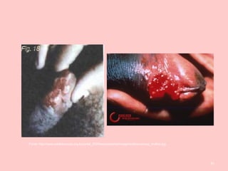 41
Fonte: http://www.adolescencia.org.br/portal_2005/secoes/saiba/imagens/donovanose_mulher.jpg
 