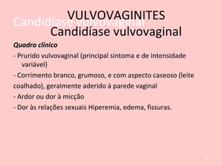 Candidíase vulvovaginal
Quadro clínico
- Prurido vulvovaginal (principal sintoma e de intensidade
variável)
- Corrimento branco, grumoso, e com aspecto caseoso (leite
coalhado), geralmente aderido à parede vaginal
- Ardor ou dor à micção
- Dor às relações sexuais Hiperemia, edema, fissuras.
73
VULVOVAGINITES
Candidíase vulvovaginal
 