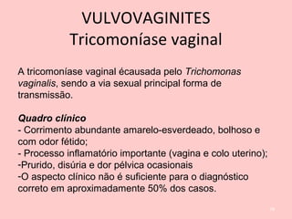 A tricomoníase vaginal écausada pelo Trichomonas
vaginalis, sendo a via sexual principal forma de
transmissão.
Quadro clínico
- Corrimento abundante amarelo-esverdeado, bolhoso e
com odor fétido;
- Processo inflamatório importante (vagina e colo uterino);
-Prurido, disúria e dor pélvica ocasionais
-O aspecto clínico não é suficiente para o diagnóstico
correto em aproximadamente 50% dos casos.
78
VULVOVAGINITES
Tricomoníase vaginal
 