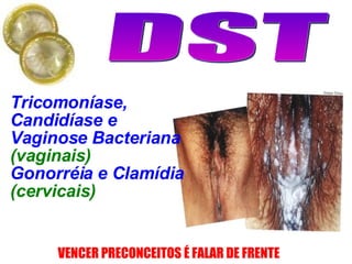 Tricomoníase, Candidíase e Vaginose Bacteriana   (vaginais) Gonorréia e Clamídia (cervicais) 