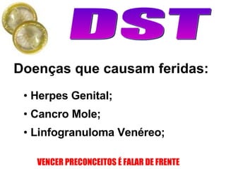 Doenças que causam feridas: Herpes Genital; Cancro Mole; Linfogranuloma Venéreo; 