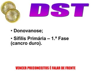 Donovanose; Sífilis Primária – 1.ª Fase (cancro duro). 