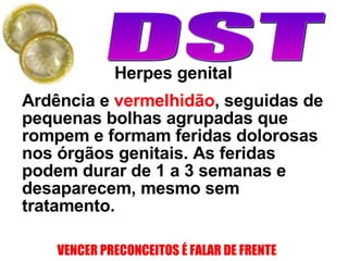 Ardência e  vermelhidão , seguidas de pequenas bolhas agrupadas que rompem e formam feridas dolorosas nos órgãos genitais. As feridas podem durar de 1 a 3 semanas e desaparecem, mesmo sem tratamento.  Herpes genital 