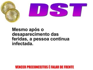 Mesmo após o desaparecimento das feridas, a pessoa continua infectada. 