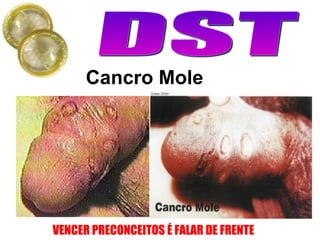 Cancro Mole                                                                                                       