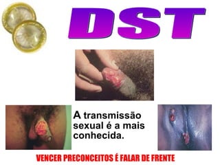 A  transmissão sexual é a mais conhecida.                                                                            