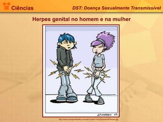 Ciências DST: Doença Sexualmente Transmissível
Herpes genital no homem e na mulher
http://www.youngandhealthy.ca/caah/Portals/1/img/illustrations/herpes.jpg
 