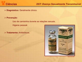 Ciências DST: Doença Sexualmente Transmissível
 Diagnóstico: Geralmente clínico.
 Prevenção:
Uso de camisinha durante as relações sexuais.
Higiene pessoal.
 Tratamento: Antibióticos.
Arquivo do autor
 