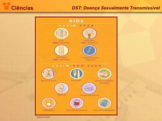 Ciências DST: Doença Sexualmente Transmissível
Arquivo do autor
 