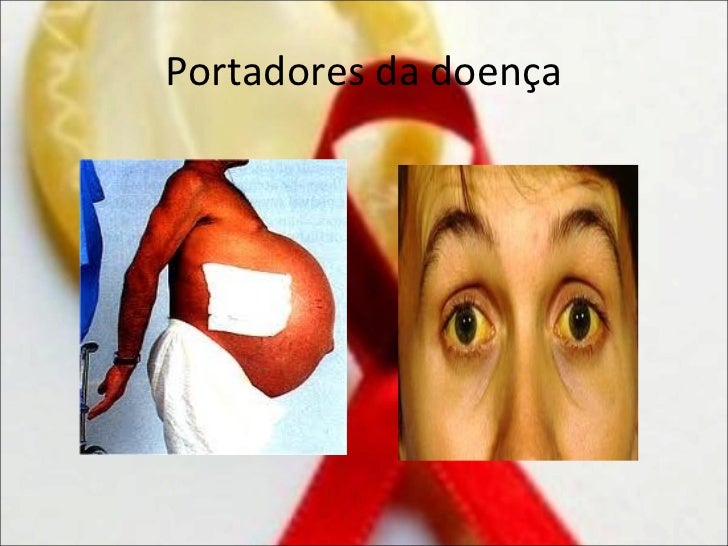 Quanto tempo leva para o virus hiv aparecer no exame