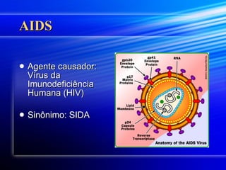 AIDS Agente causador: Vírus da Imunodeficiência Humana (HIV) Sinônimo: SIDA 