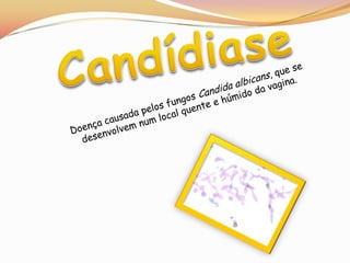 Candídiase	Doença causada pelos fungos Candida albicans, que se desenvolvem num local quente e húmido da vagina.