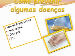 Como prevenir algumas doençasUso de PreservativoAnel vaginalCirurgiasEtc