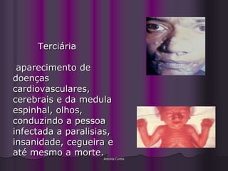 Terciária

 aparecimento de
doenças
cardiovasculares,
cerebrais e da medula
espinhal, olhos,
conduzindo a pessoa
infectada a paralisias,
insanidade, cegueira e
até mesmo a morte.
                    Antonia Cunha
 