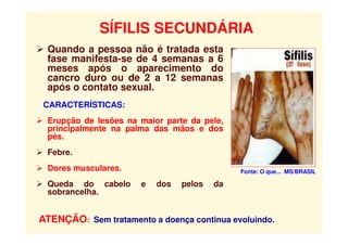 SÍFILIS SECUNDÁRIA
 Quando a pessoa não é tratada esta
fase manifesta-se de 4 semanas a 6
meses após o aparecimento do
cancro duro ou de 2 a 12 semanas
após o contato sexual.
CARACTERÍSTICAS:
 Erupção de lesões na maior parte da pele,
principalmente na palma das mãos e dos
pés.
 Febre.
 Dores musculares.
 Queda do cabelo e dos pelos da
sobrancelha.
Fonte: O que... MS/BRASIL
ATENÇÃO: Sem tratamento a doença continua evoluindo.
 