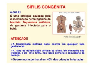 Fonte: www.eca.usp.br
O QUE É?
É uma infecção causada pela
disseminação hematogênica da
bactéria Treponema pallidum,
da gestante infectada para o
bebê.
SÍFILIS CONGÊNITA
ATENÇÃO!!
A transmissão materna pode ocorrer em qualquer fase
gestacional.
A taxa de transmissão vertical da sífilis, em mulheres não
tratadas, é de 70 a 100%, nas fases primária e secundária da
doença.
Ocorre morte perinatal em 40% das crianças infectadas
 
