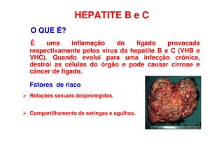 HEPATITE B e C
O QUE É?
É uma inflamação do fígado provocada
respectivamente pelos vírus da hepatite B e C (VHB e
VHC). Quando evolui para uma infecção crônica,
destrói as células do órgão e pode causar cirrose e
câncer de fígado.
Fatores de risco
 Relações sexuais desprotegidas.
 Compartilhamento de seringas e agulhas.
 
