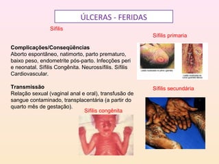 ÚLCERAS - FERIDAS
Sífilis
Complicações/Conseqüências
Aborto espontâneo, natimorto, parto prematuro,
baixo peso, endometrite pós-parto. Infecções peri
e neonatal. Sífilis Congênita. Neurossífilis. Sífilis
Cardiovascular.
Transmissão
Relação sexual (vaginal anal e oral), transfusão de
sangue contaminado, transplacentária (a partir do
quarto mês de gestação).
Sífilis primaria
Sífilis secundária
Sífilis congênita
 