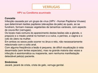 VERRUGAS
HPV ou Condiloma acuminado
Conceito
Infecção causada por um grupo de vírus (HPV - Human Papiloma Viruses)
que determinam lesões papilares (elevações da pele) as quais, ao se
fundirem, formam massas vegetantes de tamanhos variáveis, com aspecto
de couve-flor (verrugas).
Os locais mais comuns do aparecimento destas lesões são a glande, o
prepúcio e o meato uretral no homem e a vulva, o períneo, a vagina e o
colo do útero na mulher.
Em ambos os sexos pode ocorrer no ânus e reto, não necessariamente
relacionado com o coito anal.
Com alguma freqüência a lesão é pequena, de difícil visualização à vista
desarmada (sem lentes especiais), mas na grande maioria das vezes a
infecção é assintomática ou inaparente, sem nenhuma manifestação
detectável pelo(a) paciente.
Sinônimos
Jacaré, jacaré de crista, crista de galo, verruga genital.
 