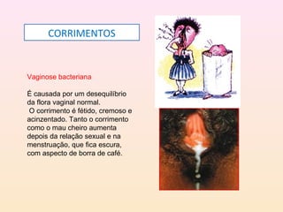Vaginose bacteriana
É causada por um desequilíbrio
da flora vaginal normal.
O corrimento é fétido, cremoso e
acinzentado. Tanto o corrimento
como o mau cheiro aumenta
depois da relação sexual e na
menstruação, que fica escura,
com aspecto de borra de café.
CORRIMENTOS
 