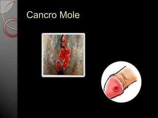 Cancro Mole

 