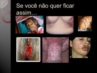 Se você não quer ficar
assim…

 