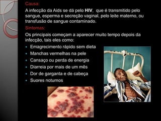 Causa:
A infecção da Aids se dá pelo HIV, que é transmitido pelo
sangue, esperma e secreção vaginal, pelo leite materno, ou
transfusão de sangue contaminado.
Sintomas:
Os principais começam a aparecer muito tempo depois da
infecção, tais eles como:
 Emagrecimento rápido sem dieta
 Manchas vermelhas na pele
 Cansaço ou perda de energia
 Diarreia por mais de um mês
 Dor de garganta e de cabeça
 Suores noturnos

 