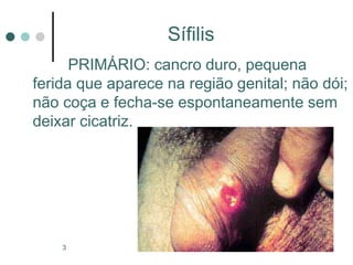 Professora Bárbara Lemos3
Sífilis
PRIMÁRIO: cancro duro, pequena
ferida que aparece na região genital; não dói;
não coça e fecha-se espontaneamente sem
deixar cicatriz.
 