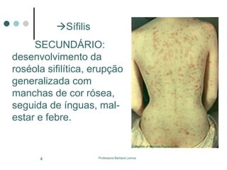 Professora Bárbara Lemos4
Sífilis
SECUNDÁRIO:
desenvolvimento da
roséola sifilítica, erupção
generalizada com
manchas de cor rósea,
seguida de ínguas, mal-
estar e febre.
 