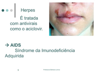 Professora Bárbara Lemos9
Herpes
É tratada
com antivirais
como o aciclovir.
 AIDS
Síndrome da Imunodeficiência
Adquirida
 