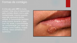 Formas de contágio
A infecção pelo HPV é muito
comum. Esse vírus é transmitido
pelo contato direto com a pele
contaminada, mesmo quando
essa não apresenta lesões
visíveis. A transmissão também
pode ocorrer durante o sexo
oral. Há, ainda, a possibilidade
de contaminação por meio de
objetos como toalhas, roupas
íntimas, vasos sanitários ou
banheiras.
 
