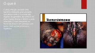 O que é
É uma infecção causada pela
bactéria Klebsiella granulomatis,
que afeta a pele e mucosas das
regiões da genitália, da virilha e do
ânus. Causa úlceras e destrói a pele
infectada. É mais frequente no
Norte do Brasil e em pessoas com
baixo nível socioeconômico e
higiênico.
 