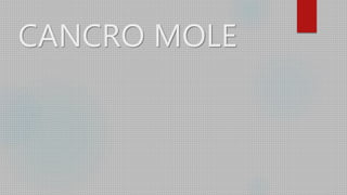 CANCRO MOLE
 