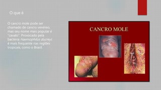 O que é
O cancro mole pode ser
chamado de cancro venéreo,
mas seu nome mais popular é
“cavalo”. Provocado pela
bactéria Haemophilus ducreyi,
é mais frequente nas regiões
tropicais, como o Brasil.
 