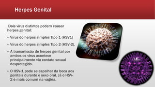 Herpes Genital
Dois vírus distintos podem causar
herpes genital:
 Vírus do herpes simples Tipo 1 (HSV1)
 Vírus do herpes simples Tipo 2 (HSV-2).
 A transmissão de herpes genital por
ambos os vírus acontece
principalmente via contato sexual
desprotegido.
 O HSV-1 pode se espalhar da boca aos
genitais durante o sexo oral. Já o HSV-
2 é mais comum na vagina.
 