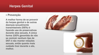 Herpes Genital
 Prevenção
A melhor forma de se prevenir
da herpes genital e de outras
doenças sexualmente
transmissíveis (DSTs) é
fazendo uso de preservativos
durante atos sexuais. A única
forma 100% garantida de não
se contrair nenhum tipo de
DST é não manter relações
sexuais, então quanto mais
cuidado tiver durante o ato,
melhor.
 