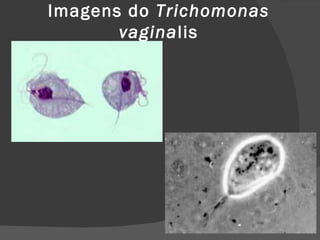 Imagens do Trichomonas
       vaginalis
 