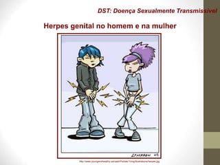 DST: Doença Sexualmente Transmissível
Herpes genital no homem e na mulher
http://www.youngandhealthy.ca/caah/Portals/1/img/illustrations/herpes.jpg
 